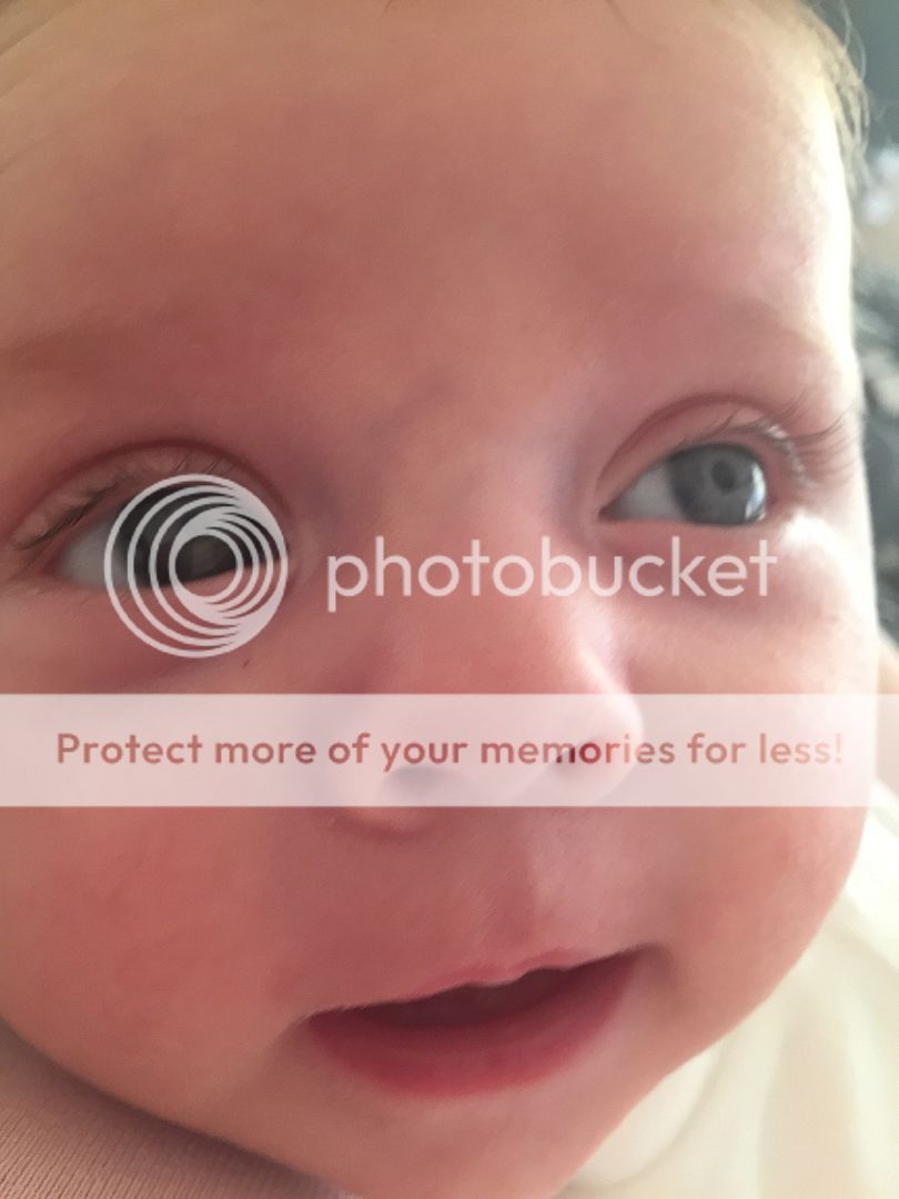 Baby veins near eyes paranoia *pic included* BabyCentre